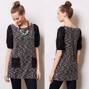 Staccato Lace Sleeve Tunic Dress